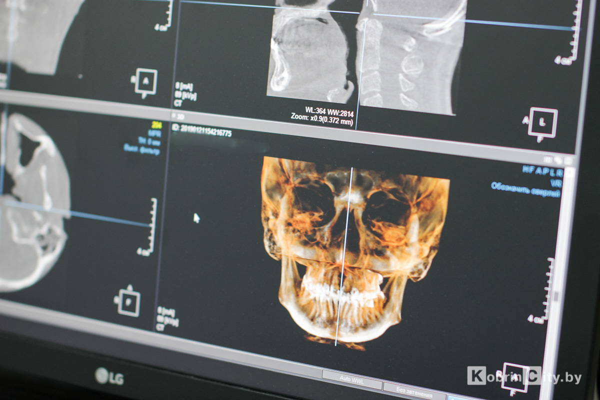 3D-снимок зубов уже в Кобрине. Полная диагностика на компьютерном  3D-томографе в стоматологии «ДЕКО»